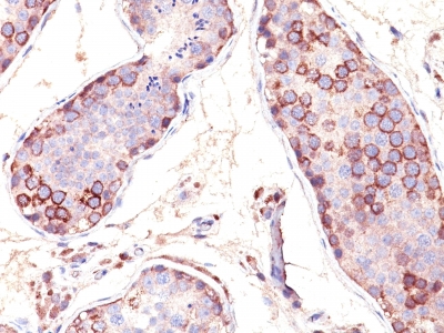 Formalin-fixed, paraffin embedded human testis sections stained with 100 ul anti-MAGE-1 (clone SPM282) at 1:100. HIER epitope retrieval prior to staining was performed in 10mM Citrate, pH 6.0.